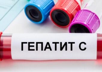 ВІРУСНИЙ ГЕПАТИТ C